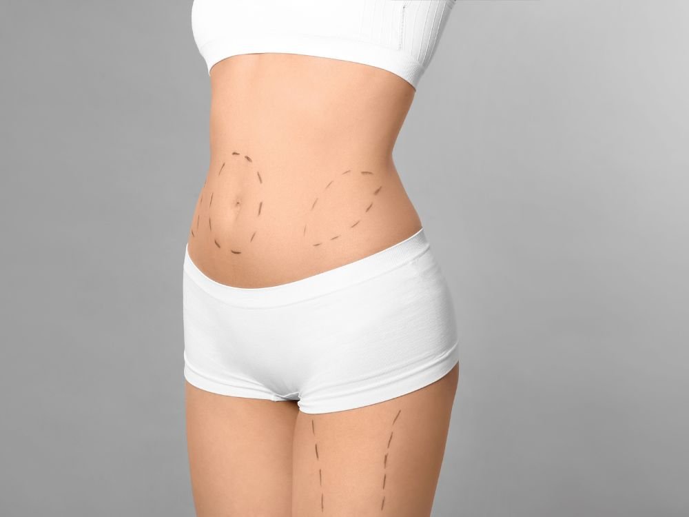 Plastic Surgery in Santa Catarina Why International Patients Choose Belvivere