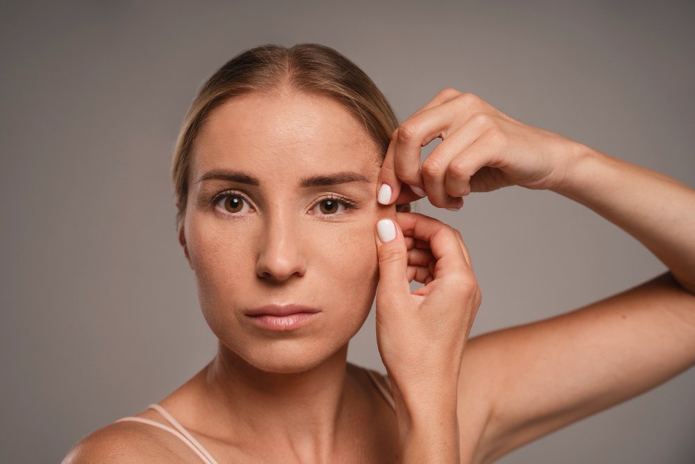 Blepharoplasty and Botox